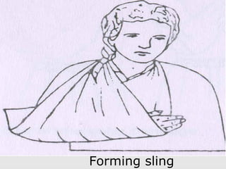 Forming sling
 