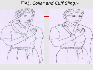 A). Collar and Cuff Sling:-
 
