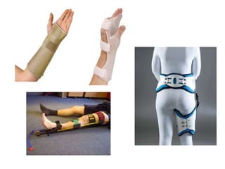 Bandaging and Splinting & Slings; Techniques and Types (Health Subject ...