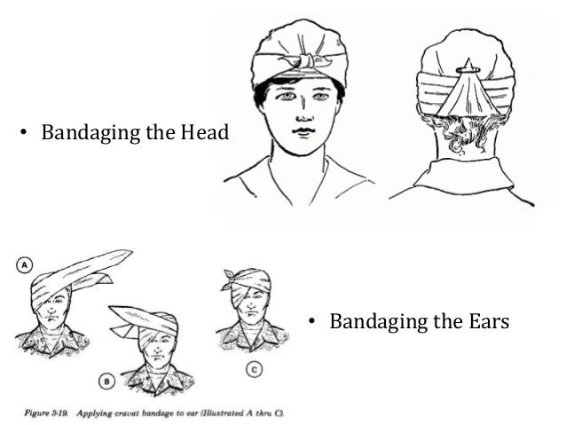 10 types of bandaging