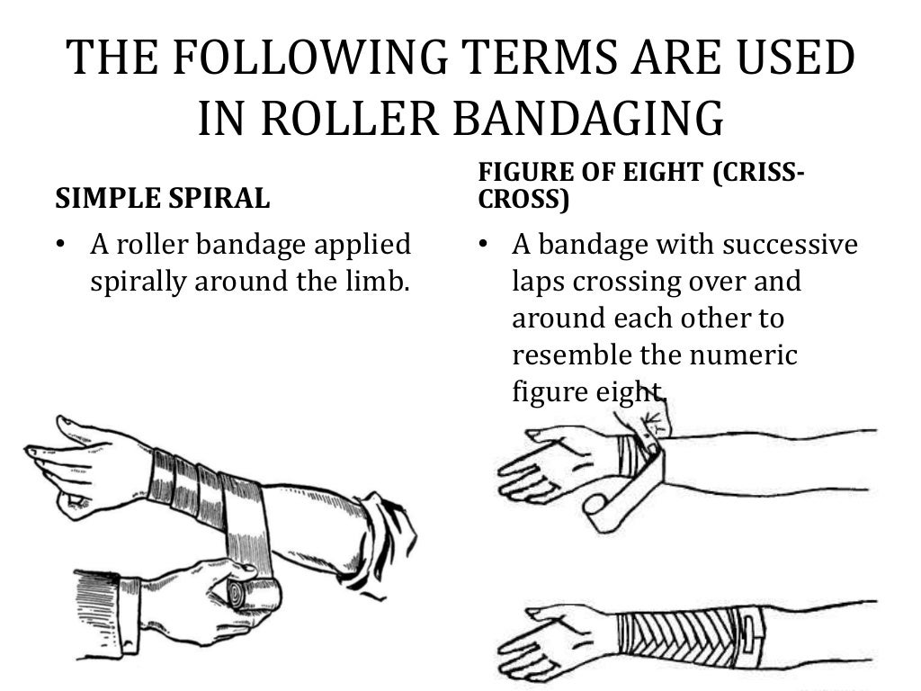 Bandaging and Splinting & Slings; Techniques and Types (Health Subjec…
