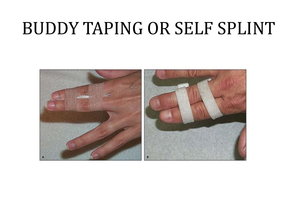 Bandaging and Splinting & Slings; Techniques and Types (Health Subjec…