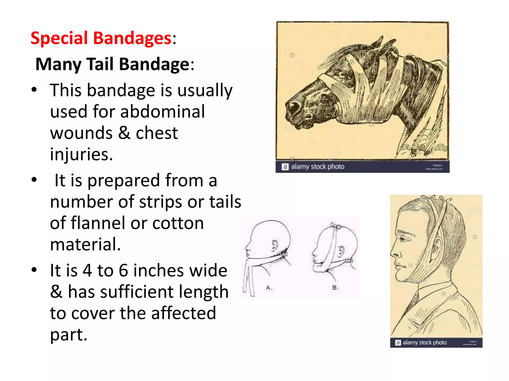 Special Bandages:
Many Tail Bandage:
• This bandage is usually
used for abdominal
wounds & chest
injuries.
• It is prepared from a
number of strips or tails
of flannel or cotton
material.
• It is 4 to 6 inches wide
& has sufficient length
to cover the affected
part.
 