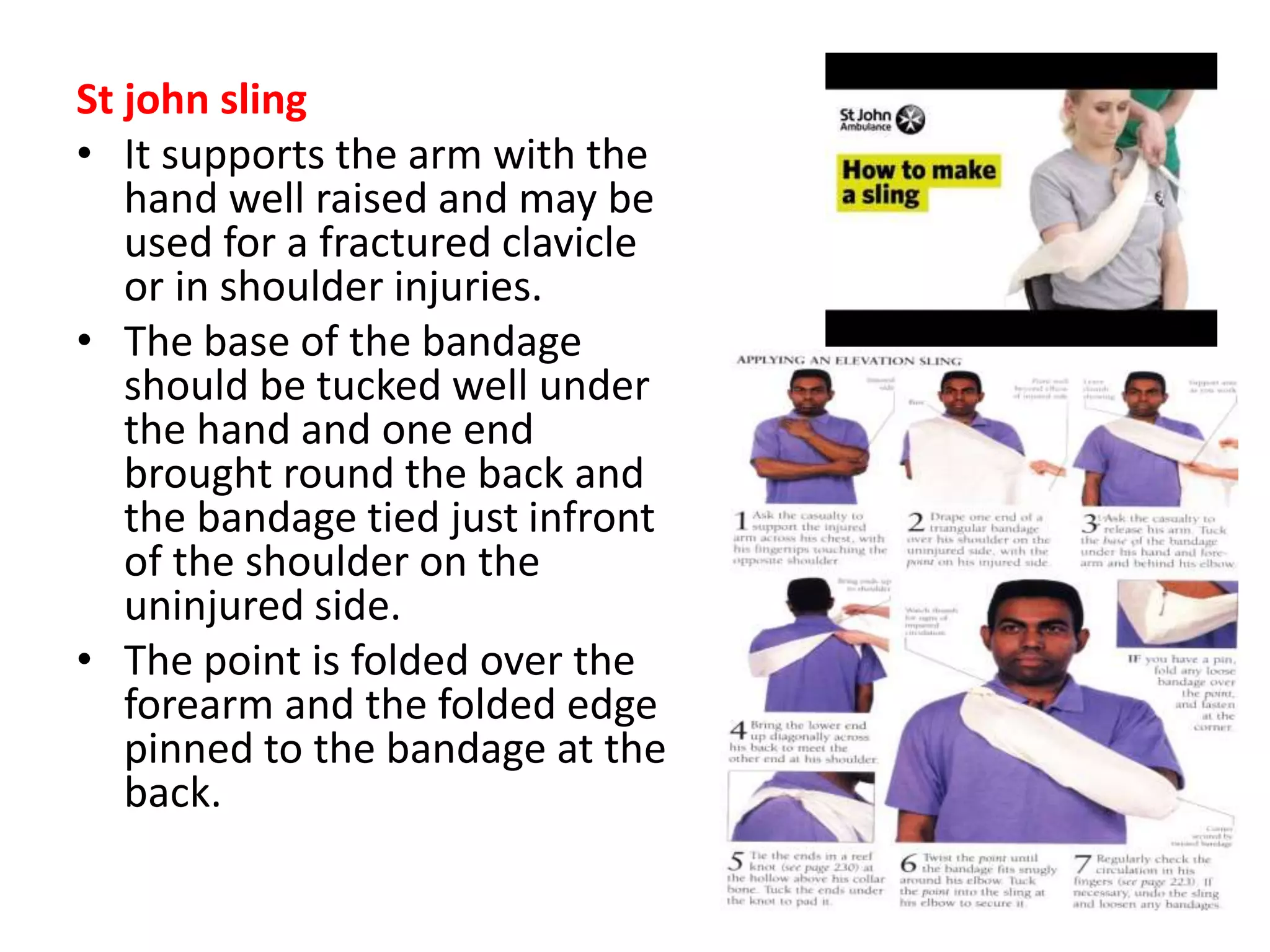 St john sling
• It supports the arm with the
hand well raised and may be
used for a fractured clavicle
or in shoulder injuries.
• The base of the bandage
should be tucked well under
the hand and one end
brought round the back and
the bandage tied just infront
of the shoulder on the
uninjured side.
• The point is folded over the
forearm and the folded edge
pinned to the bandage at the
back.
 