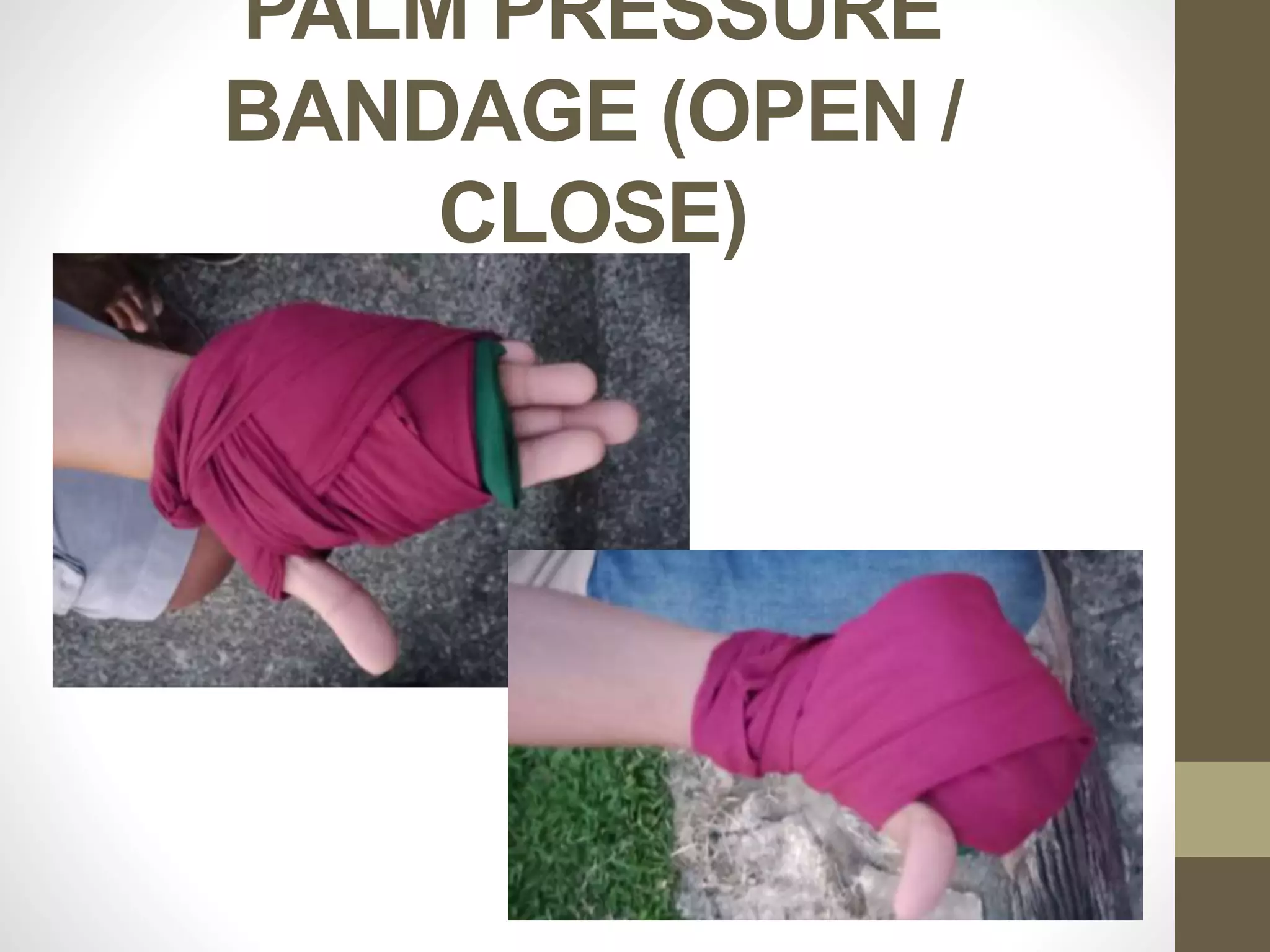 PALM PRESSURE
BANDAGE (OPEN /
CLOSE)
