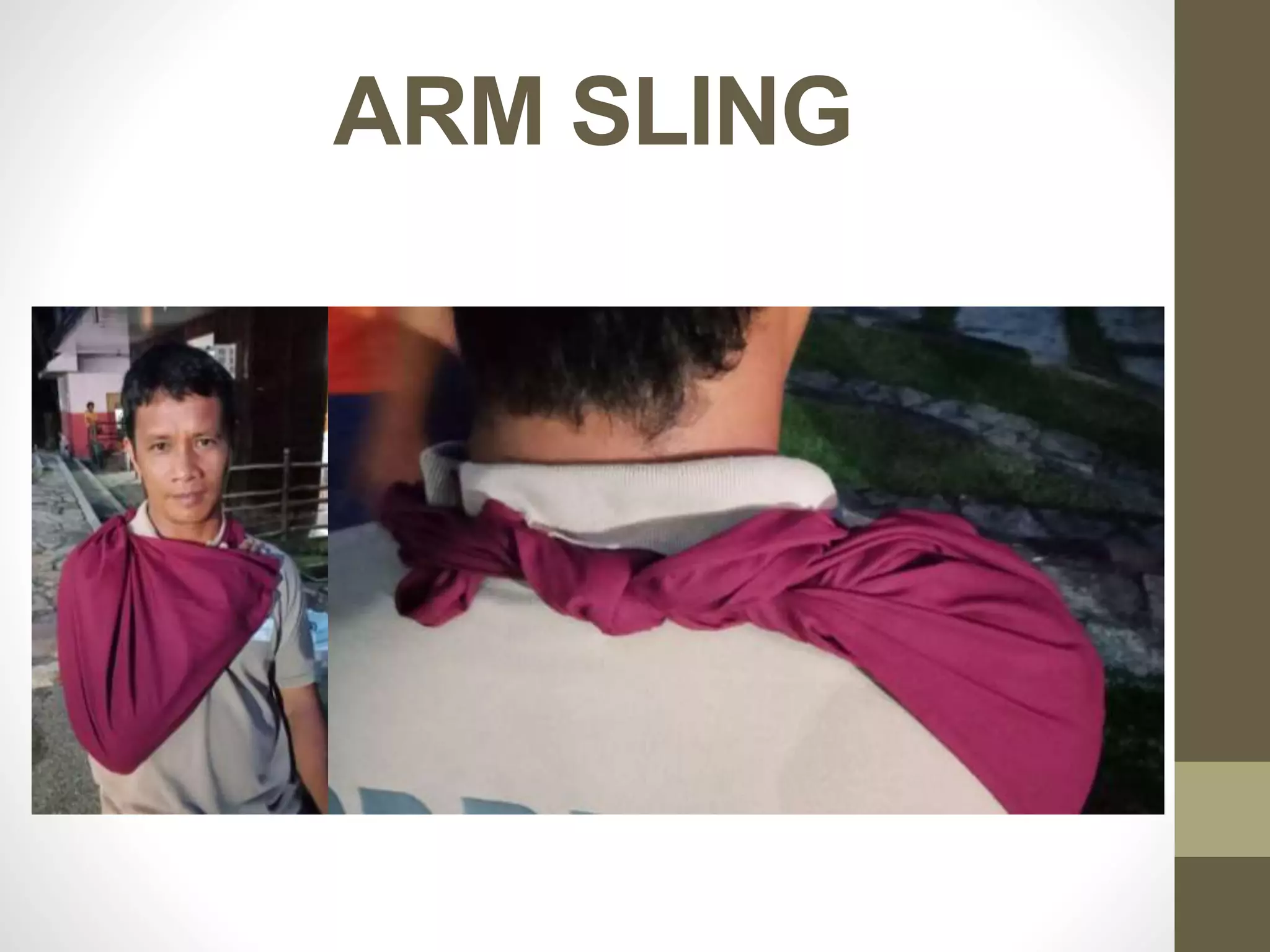 ARM SLING