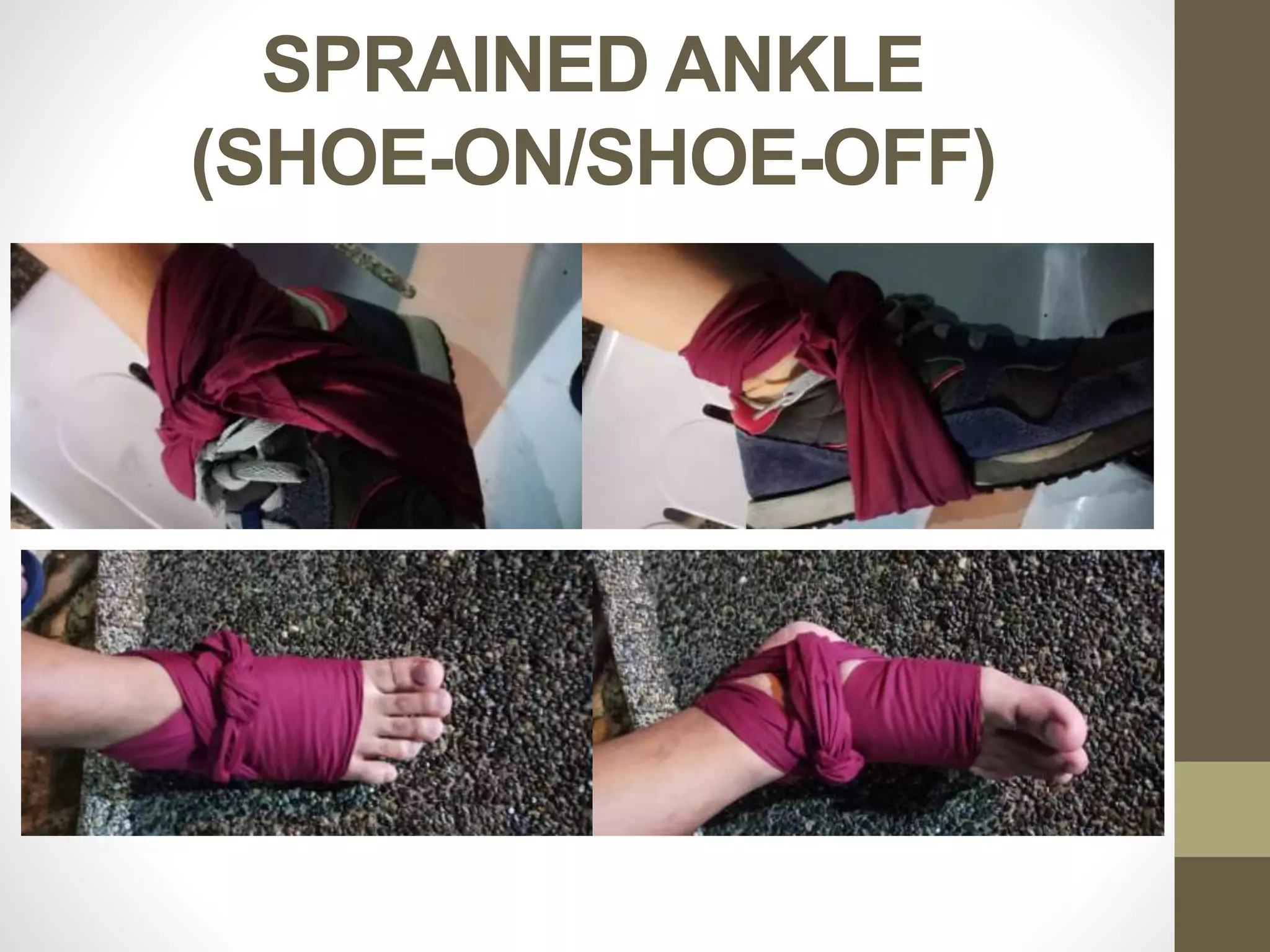 SPRAINED ANKLE
(SHOE-ON/SHOE-OFF)