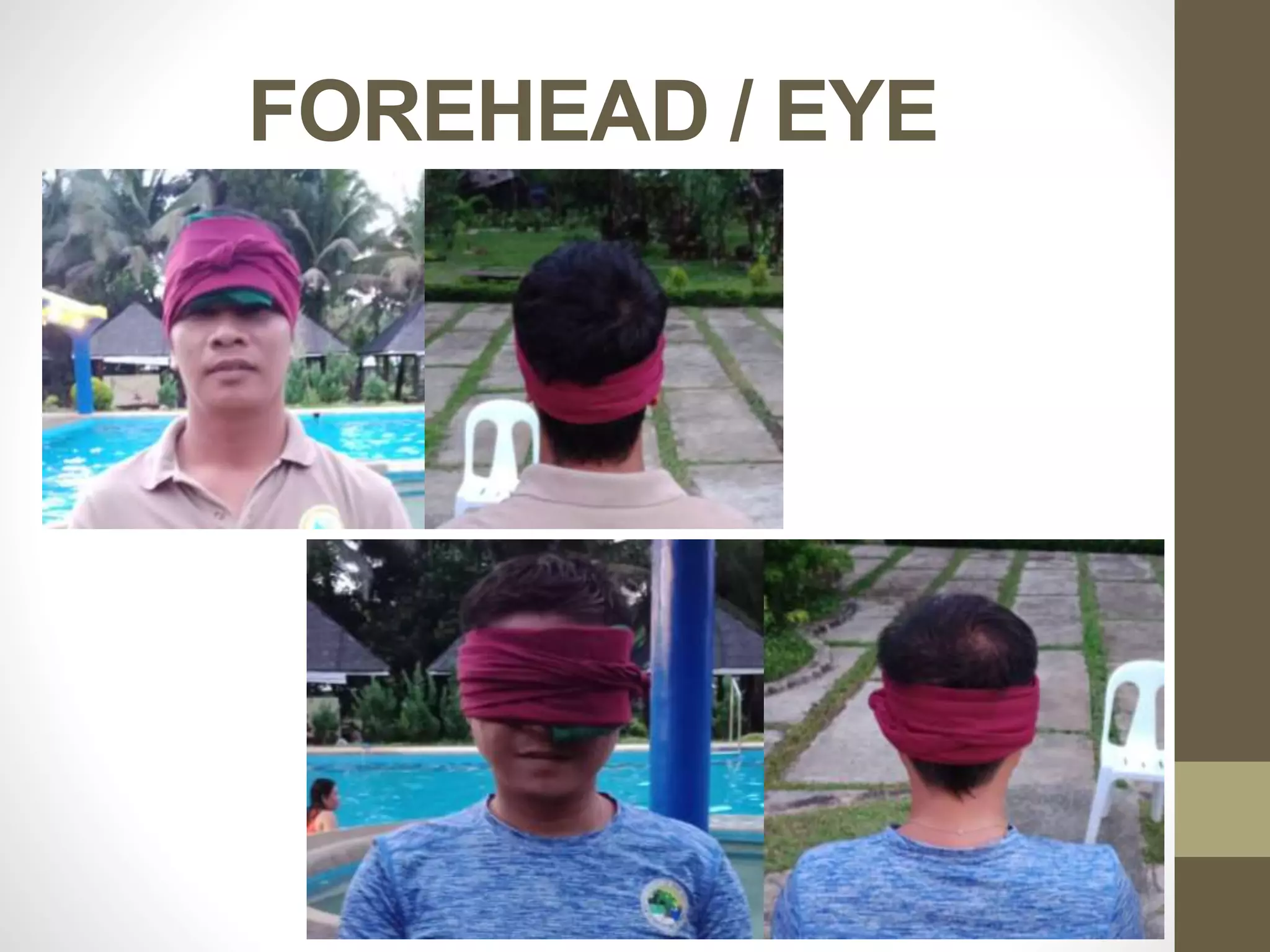 FOREHEAD / EYE
