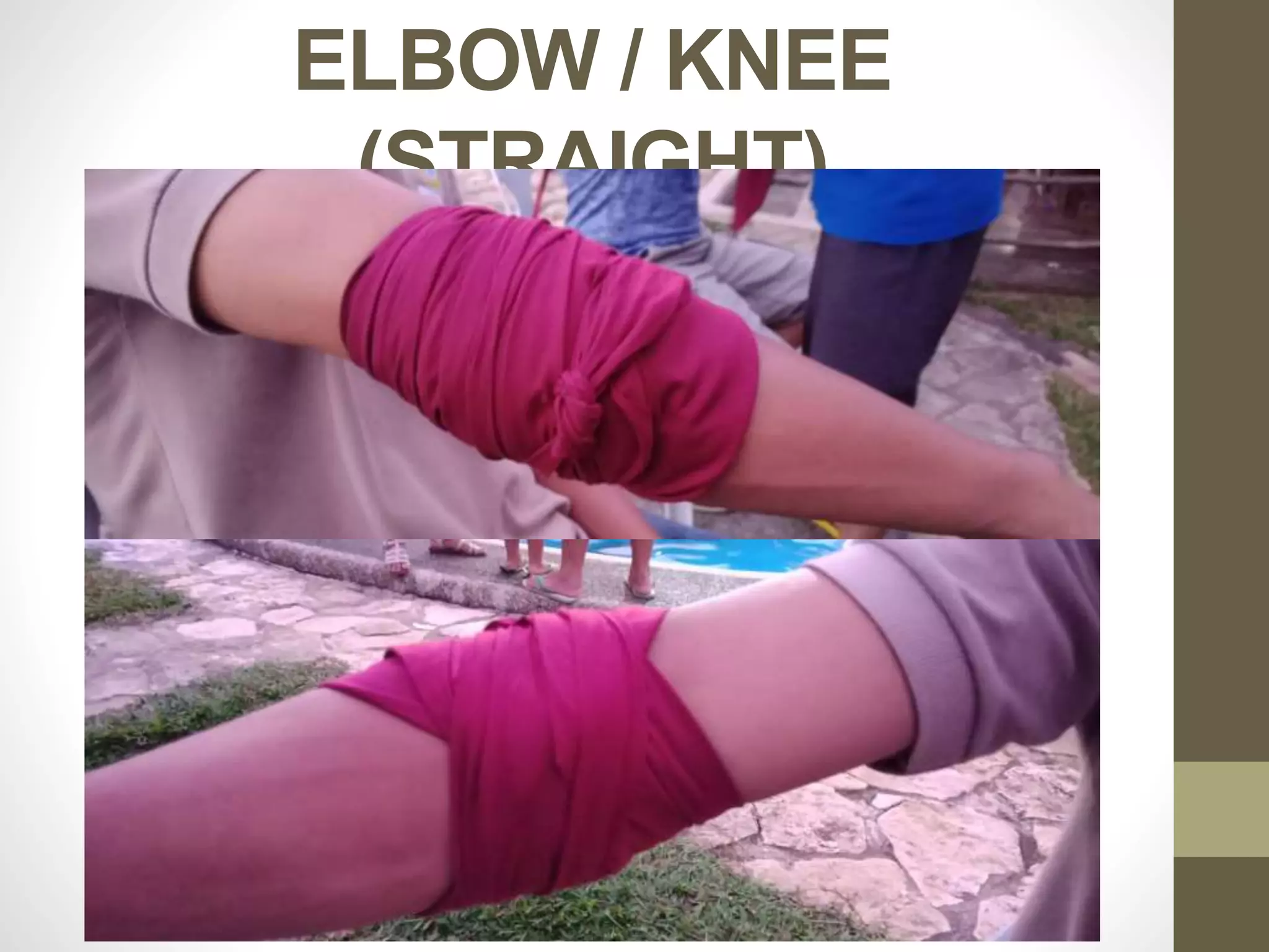 ELBOW / KNEE
(STRAIGHT)