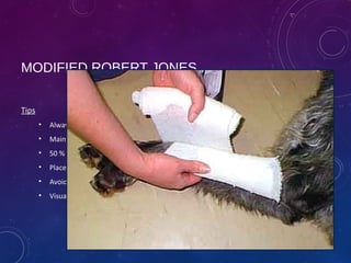 Modified Jones Method Bandaging principles and techniques | PPT