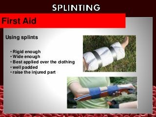 bandagingsplinting-150214215533-conversion-gate01.ppt