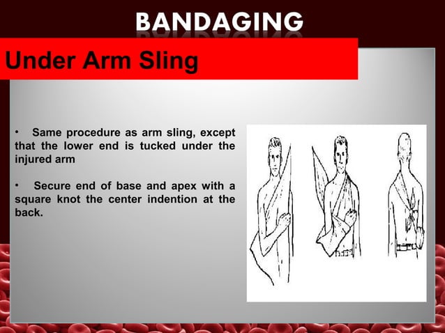 Bandaging&splinting | PPT | First Aid | Injuries