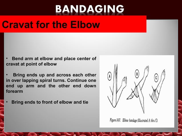 Bandaging&splinting | PPT | First Aid | Injuries