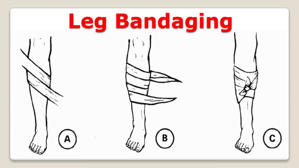 Bandaging Techniques