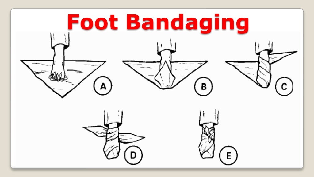 Bandaging Techniques