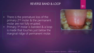 Band and loop space maintainer | PPTX