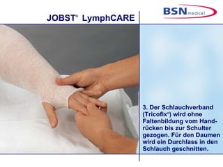 3. Der Schlauchverband (Tricofix ® ) wird ohne Faltenbildung vom Hand-rücken bis zur Schulter gezogen. Für den Daumen wird ein Durchlass in den Schlauch geschnitten. 