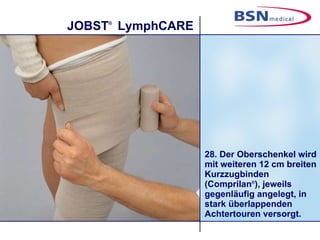 28. Der Oberschenkel wird mit weiteren 12 cm breiten Kurzzugbinden (Comprilan ® ), jeweils gegenläufig angelegt, in stark überlappenden Achtertouren versorgt.  