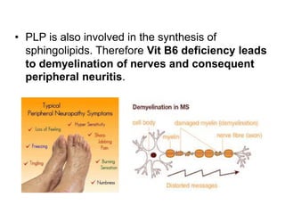 • PLP is also involved in the synthesis of
sphingolipids. Therefore Vit B6 deficiency leads
to demyelination of nerves and consequent
peripheral neuritis.
 
