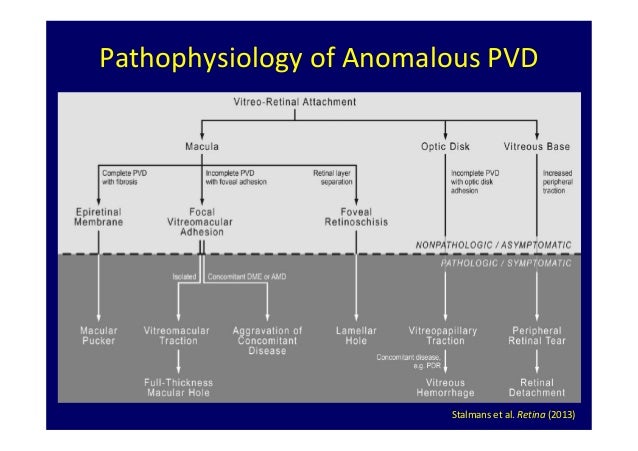 Bandello pharmacological treatment of vitreo macular traction