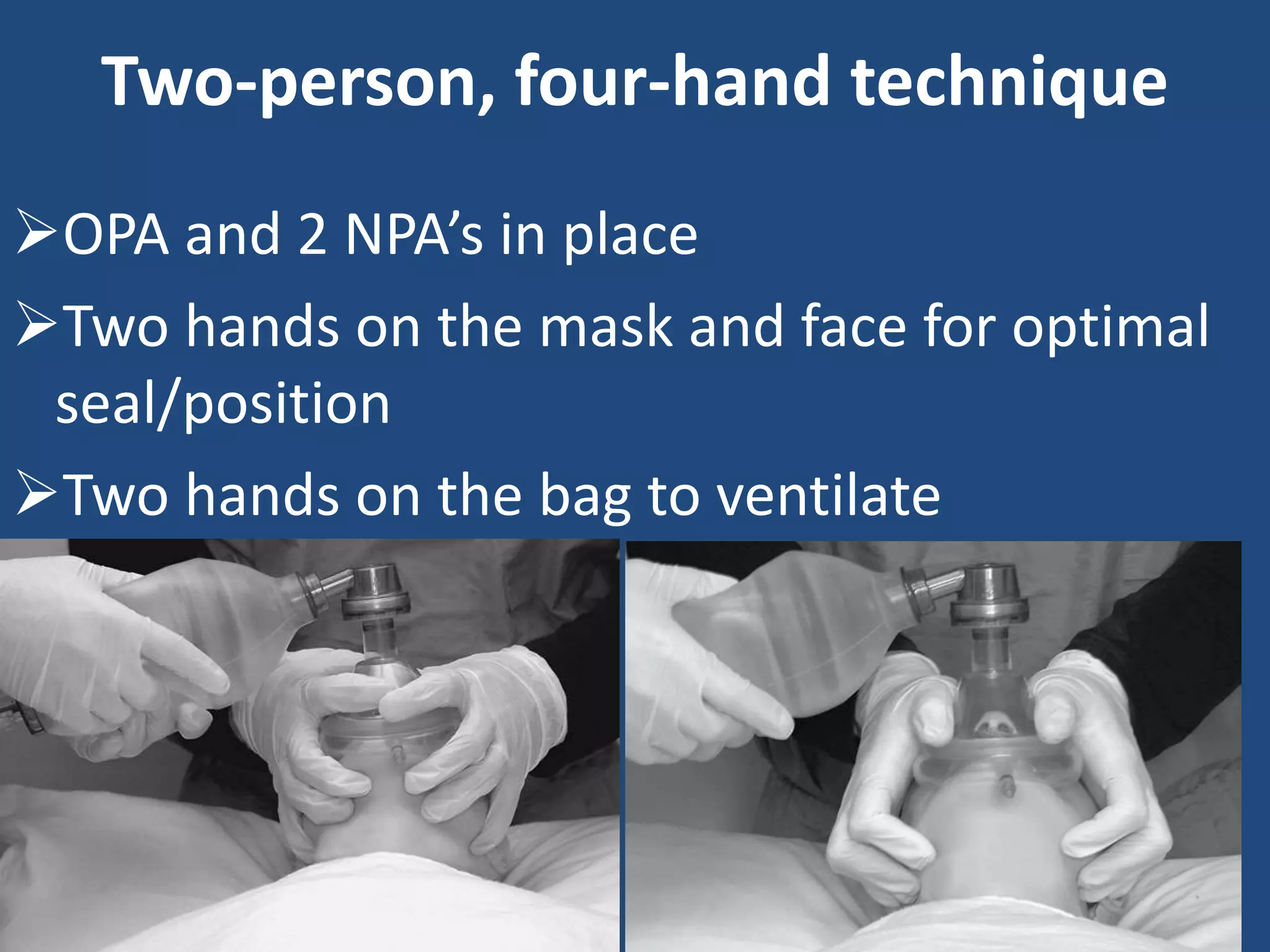 Basic airway management | PPTX