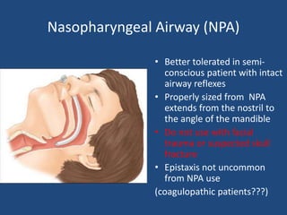 Basic airway management | PPTX