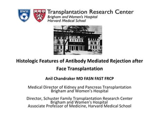 Histologic Features of Antibody Mediated Rejection after
Face Transplantation
Anil Chandraker MD FASN FAST FRCP
Medical Director of Kidney and Pancreas Transplantation
Brigham and Women’s Hospital
Director, Schuster Family Transplantation Research Center
Brigham and Women's Hospital
Associate Professor of Medicine, Harvard Medical School
 