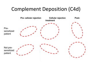 Complement Deposition (C4d)
Pre- cellular rejection Cellular rejection Post-
treatment
Pre-
sensitized
patient
Not pre-
sensitized
patient
 