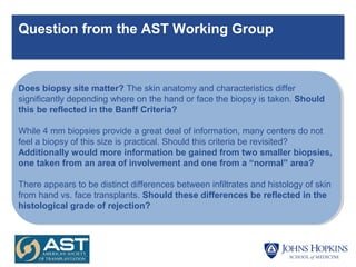 Question from the AST Working Group
Does biopsy site matter? The skin anatomy and characteristics differ
significantly depending where on the hand or face the biopsy is taken. Should
this be reflected in the Banff Criteria?
While 4 mm biopsies provide a great deal of information, many centers do not
feel a biopsy of this size is practical. Should this criteria be revisited?
Additionally would more information be gained from two smaller biopsies,
one taken from an area of involvement and one from a “normal” area?
There appears to be distinct differences between infiltrates and histology of skin
from hand vs. face transplants. Should these differences be reflected in the
histological grade of rejection?
 