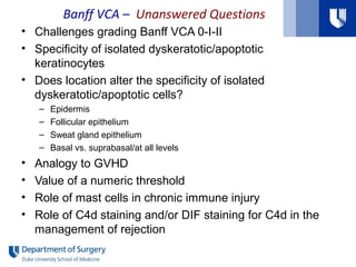 • Challenges grading Banff VCA 0-I-II
• Specificity of isolated dyskeratotic/apoptotic
keratinocytes
• Does location alter the specificity of isolated
dyskeratotic/apoptotic cells?
– Epidermis
– Follicular epithelium
– Sweat gland epithelium
– Basal vs. suprabasal/at all levels
• Analogy to GVHD
• Value of a numeric threshold
• Role of mast cells in chronic immune injury
• Role of C4d staining and/or DIF staining for C4d in the
management of rejection
Banff VCA – Unanswered Questions
 