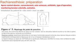 Rachianesthésie: préparation
Apres control dossier, consentement, voie veineuse, antibiotic, type d’operation,
monitoring tension arterielle, oximetre.
Installation du patient le « dos rond » avec un aide:
Soit assis, les avant-bras fléchis en appui sur les cuisses. Soit en décubitus latéral couché sur le côté à opérer,
la tête et les genoux ramenés sur la poitrine.
Repéres cutanés: apophyses épineuses et une ligne horizontale passant entre les deux épines iliaques antéro-
supérieures correspondant à l'épineuse de L4 ou à l'espace interépineux L4-L5.
La ligne bi iliaque ou ligne de TUFFIER est un guide peu fiable pour identifier le niveau inter-vertébral et cette
imprécision peut représenter plus de 50% des cas.
 