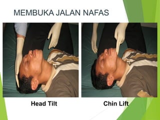 Bhd Rjp Panduan Lengkap Bantuan Hidup Dasar (BHD) dan Resusitasi Jantung Paru ...