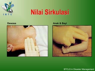 Nilai Sirkulasi
Dewasa Anak & Bayi
BTCLS in Disaster Management
 