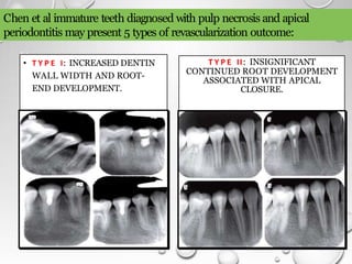 regenerative endodontics | PPTX