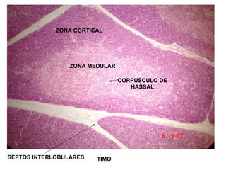 TIMO ZONA MEDULAR CORPUSCULO DE HASSAL ZONA CORTICAL SEPTOS INTERLOBULARES
