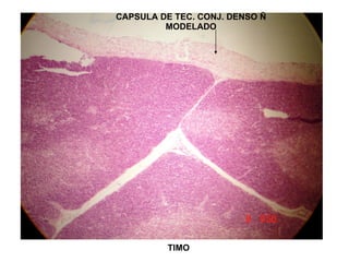 TIMO CAPSULA DE TEC. CONJ. DENSO Ñ MODELADO