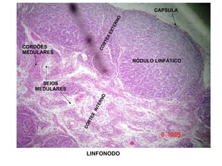 LINFONODO NÓDULO LINFÁTICO CÓRTEX EXTERNO CÓRTEX INTERNO SEIOS MEDULARES CORDÕES MEDULARES CAPSULA