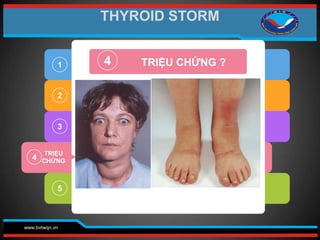www.bvtwqn.vn
2
3
4
5
4 TRIỆU CHỨNG ?
1
TRIỆU
CHỨNG
THYROID STORM
 