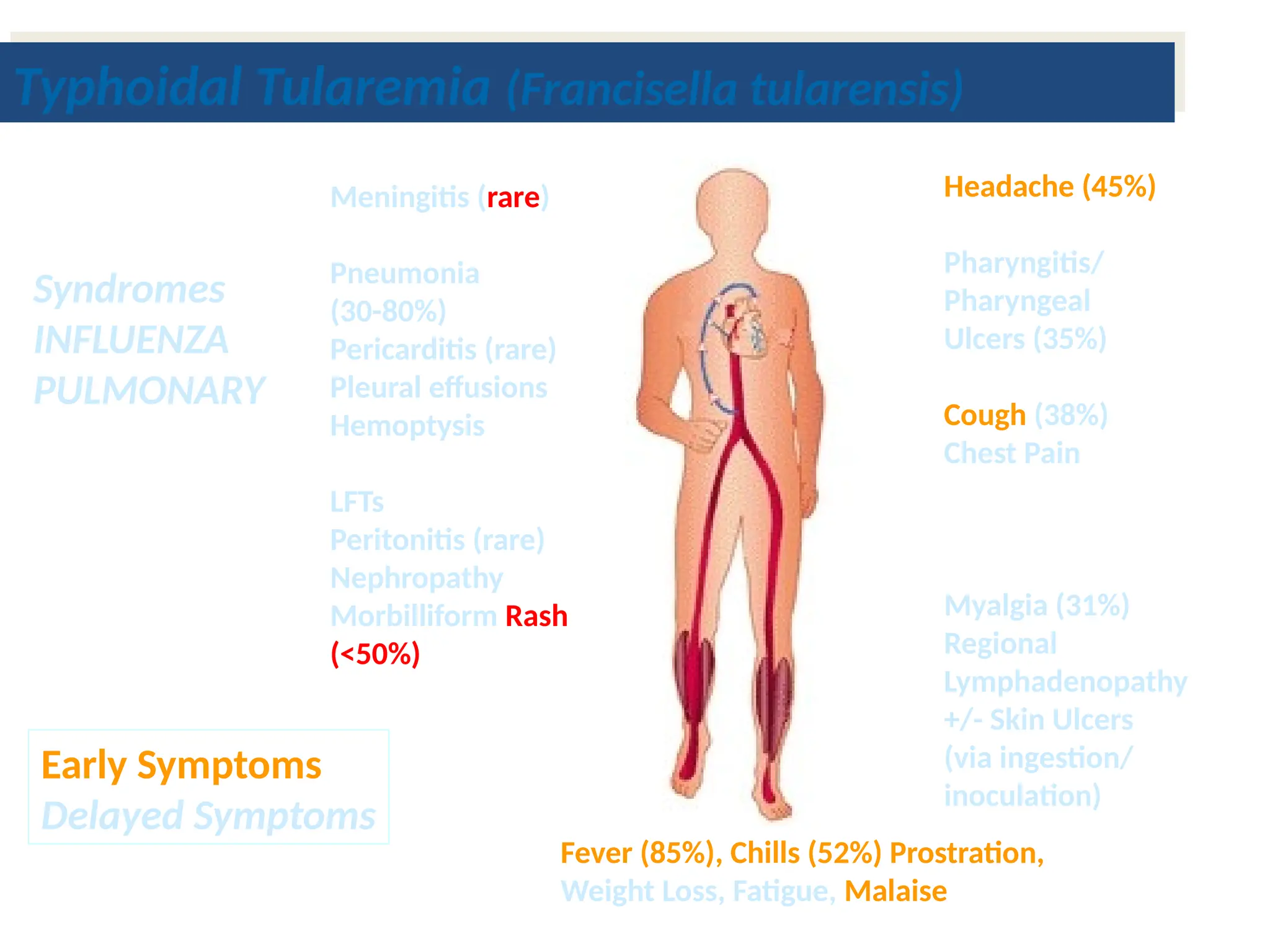 Typhoidal Tularemia (Francisella tularensis)
Syndromes
INFLUENZA
PULMONARY
Meningitis (rare)
Pneumonia
(30-80%)
Pericarditis (rare)
Pleural effusions
Hemoptysis
LFTs
Peritonitis (rare)
Nephropathy
Morbilliform Rash
(<50%)
Headache (45%)
Pharyngitis/
Pharyngeal
Ulcers (35%)
Cough (38%)
Chest Pain
Myalgia (31%)
Regional
Lymphadenopathy
+/- Skin Ulcers
(via ingestion/
inoculation)
Fever (85%), Chills (52%) Prostration,
Weight Loss, Fatigue, Malaise
Early Symptoms
Delayed Symptoms
 