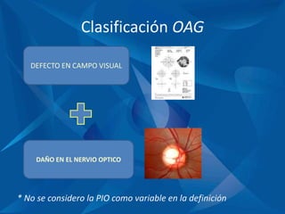 Clasificación OAG
* No se considero la PIO como variable en la definición
DEFECTO EN CAMPO VISUAL
DAÑO EN EL NERVIO OPTICO
 