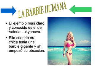 ● El ejemplo mas claro
y conocido es el de
Valeria Lukyanova.
● Ella cuando era
chica tenia una
barbie gigante y ahí
empezó su obsecion.
 