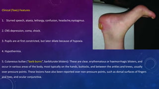 Clinical (Toxic) Features
1. Slurred speech, ataxia, lethargy, confusion, headache,nystagmus.
2. CNS depression, coma, shock.
3. Pupils are at first constricted, but later dilate because of hypoxia.
4. Hypothermia.
5. Cutaneous bullae (“barb burns”, barbiturate blisters): These are clear, erythematous or haemorrhagic blisters, and
occur in various areas of the body, most typically on the hands, buttocks, and between the ankles and knees, usually
over pressure points. These lesions have also been reported over non-pressure points, such as dorsal surfaces of fingers
and toes, and ocular conjunctiva.
 