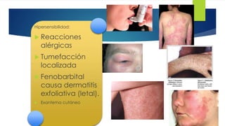 44 
Hipersensibilidad: 
 Reacciones 
alérgicas 
 Tumefacción 
localizada 
 Fenobarbital 
causa dermatitis 
exfoliativa (letal). 
 Exantema cutáneo 
 