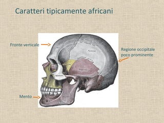 Caratteri tipicamente africani
Fronte verticale
Regione occipitale
poco prominente
Mento
 