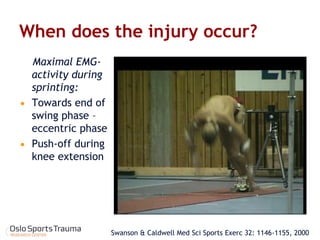 Swanson & Caldwell Med Sci Sports Exerc 32: 1146-1155, 2000 
When does the injury occur? 
Maximal EMG- activity during sprinting: 
Towards end of swing phase – eccentric phase 
Push-off during knee extension  