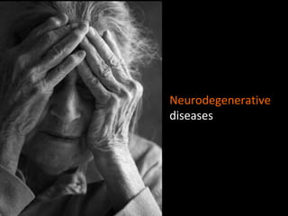 Neurodegenerative  diseases 