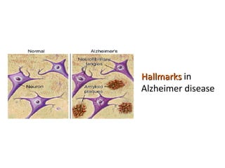 Hallmarks  in Alzheimer disease 