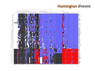 Huntington  disease 
