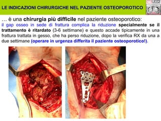 LE INDICAZIONI CHIRURGICHE NEL PAZIENTE OSTEOPOROTICO

… è una chirurgia più difficile nel paziente osteoporotico:
il gap osseo in sede di frattura complica la riduzione specialmente se il
trattamento è ritardato (3-6 settimane) e questo accade tipicamente in una
frattura trattata in gesso, che ha perso riduzione, dopo la verifica RX da una a
due settimane (operare in urgenza differita il paziente osteoporotico!).

 