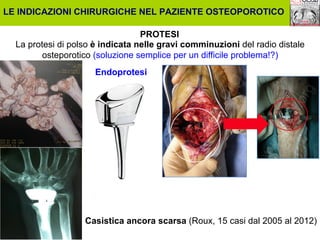 LE INDICAZIONI CHIRURGICHE NEL PAZIENTE OSTEOPOROTICO
PROTESI
La protesi di polso è indicata nelle gravi comminuzioni del radio distale
osteporotico (soluzione semplice per un difficile problema!?)
Endoprotesi

Casistica ancora scarsa (Roux, 15 casi dal 2005 al 2012)

 